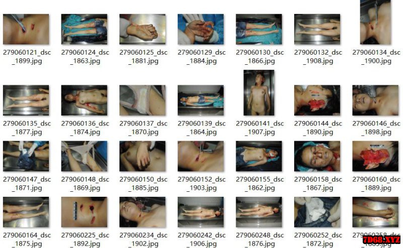 YE0619_12_国内尸检被刀砍致死的少妇，裸检验B 53P 高清图片